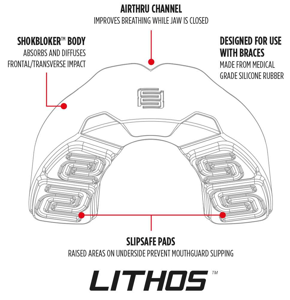 braces parts diagram