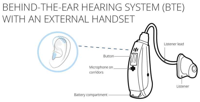 diagram hearing aid parts